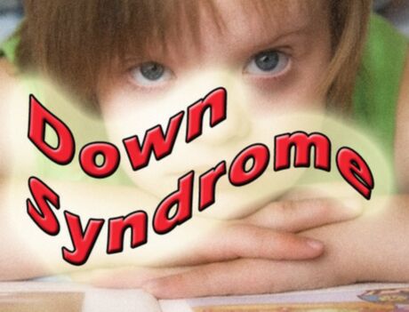 down-sindrom